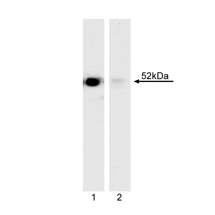 560303_wb_2_lane2.png